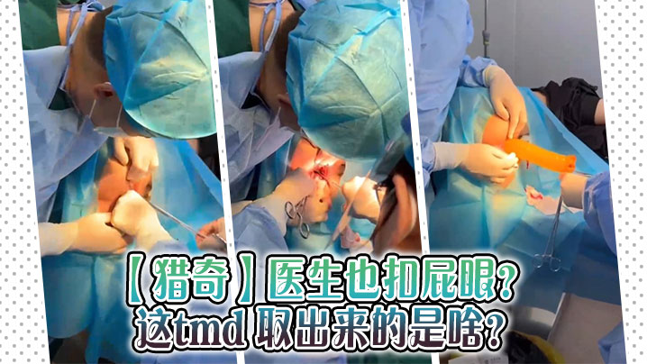 【猎奇】医生也扣屁眼？ 这tmd 取出来的是啥？封面图